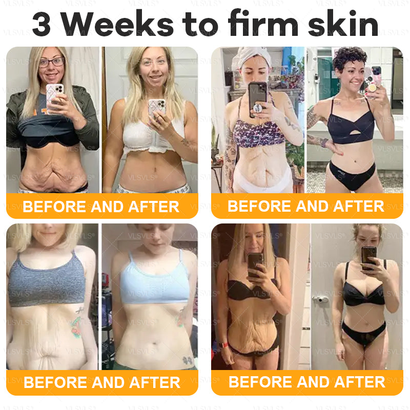 Made and Shipped from USA 🌟🌟VLSVLS® Bee Venom Comprehensive Cream  LAST DAY 80% OFF(Sagging Skin, Fine Lines, Loss of Firmness, Flat Bust, Drooping Hips, and More)