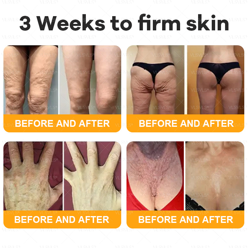 Made and Shipped from USA 🌟🌟VLSVLS® Bee Venom Comprehensive Cream  LAST DAY 80% OFF(Sagging Skin, Fine Lines, Loss of Firmness, Flat Bust, Drooping Hips, and More)
