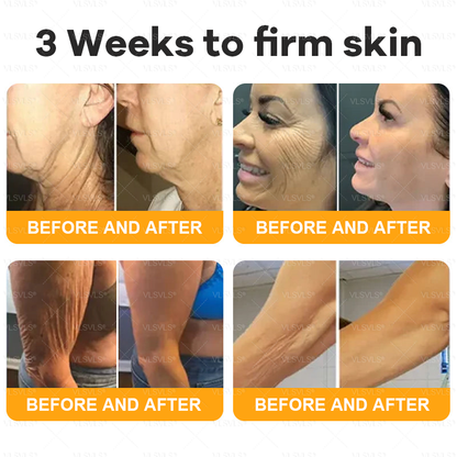Made and Shipped from USA 🌟🌟VLSVLS® Bee Venom Comprehensive Cream  LAST DAY 80% OFF(Sagging Skin, Fine Lines, Loss of Firmness, Flat Bust, Drooping Hips, and More)